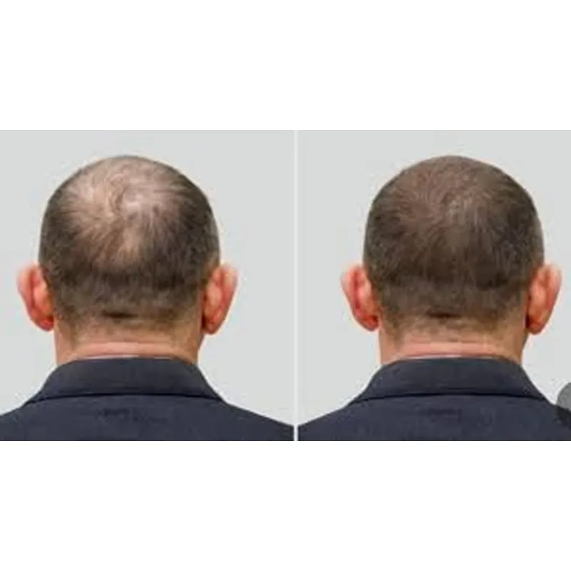 Topi Ozone Good Seal untuk Per - Hair Care Good Hair ulasan dan harga